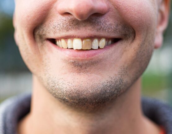 Man had sign of one of his dead tooth
